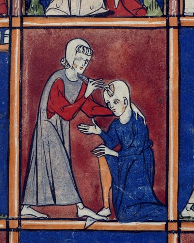 Opération sur le crâne d