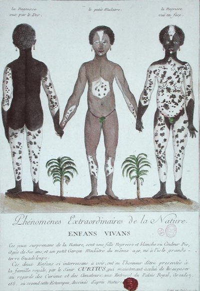 Le Phénomène de la Leucodermie - French School