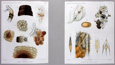 Travail sur la maladie du ver à soie présenté par Pasteur à l