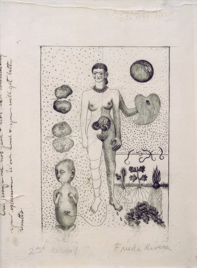 Frida et la fausse couche - Frida Kahlo
