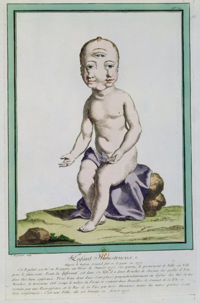 Enfant avec une tête déformée, de 