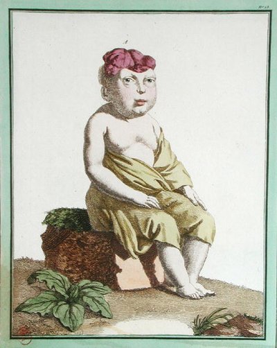 Enfant avec une Moitié de Tête, de 