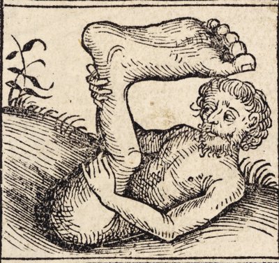 Un sciopode, Homme avec un pied enflé, de 