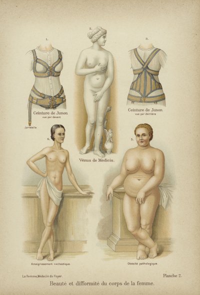 Beauté et difformité dans le corps féminin - German School