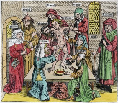Circoncision, du 