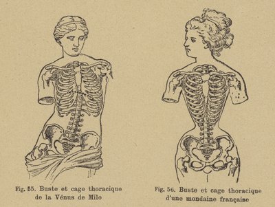 Comparaison de la forme de la poitrine et de la cage thoracique de la Vénus de Milo avec celle d