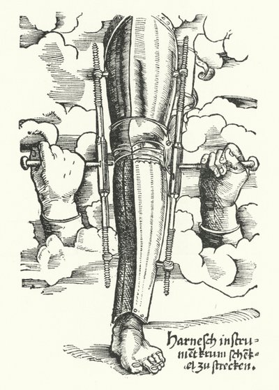 Dispositif pour redresser une jambe blessée - German School