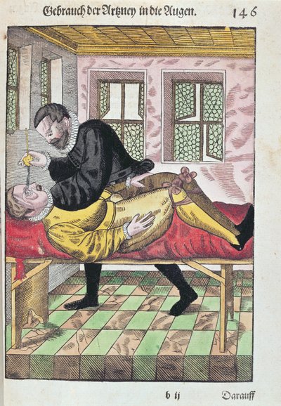 Opération de l