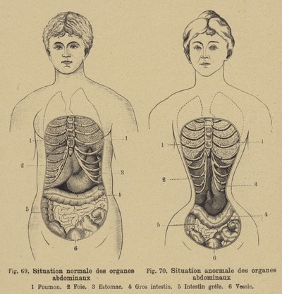 Situation normale des organes internes de l