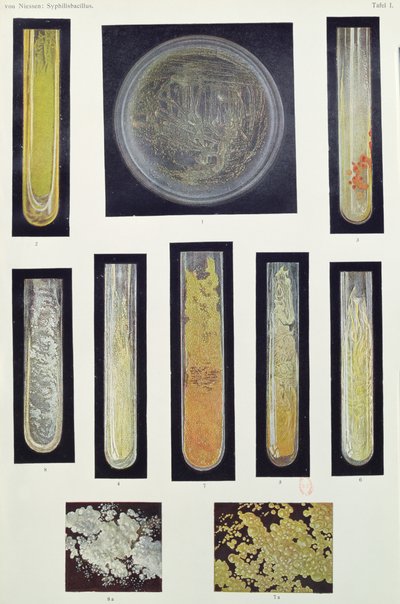 Bacille de la syphilis, d