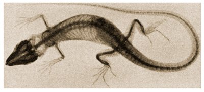 Radiographie d