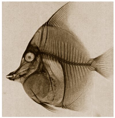 Radiographie d