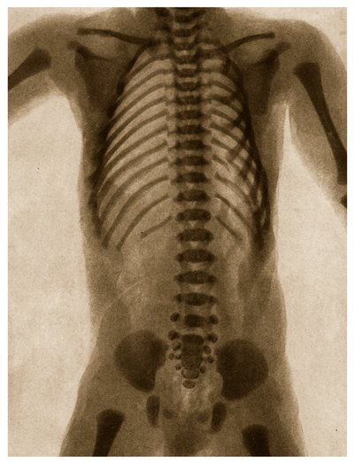 Radiographie d