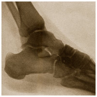 Radiographie d