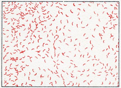 Bactérie Vibrio cholerae - German School