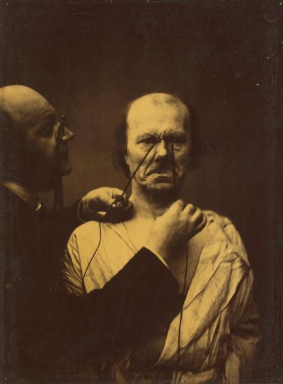 Agressivité, méchanceté, 1854-1856, imprimé 1862 (photo) - Guillaume-Benjamin-Armand Duchenne de Boulogne