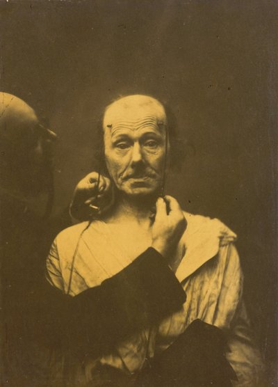 Attention,1854-1856, imprimé 1862 (photo) - Guillaume-Benjamin-Armand Duchenne de Boulogne
