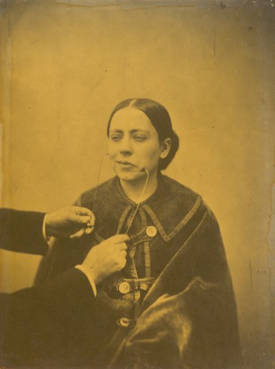 Dégoût méprisant (à gauche) ; Rire méprisant (à droite),1854-1856, imprimé en 1862 (photo) - Guillaume-Benjamin-Armand Duchenne de Boulogne