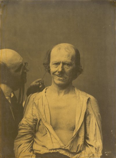 Un visage détendu (gauche) ; Joie ou rire faux (droite) - Guillaume Benjamin Amant Duchenne