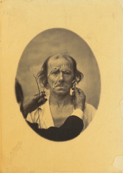Insatisfaction, pensées sombres (gauche); Réflexion (droite) - Guillaume Benjamin Amant Duchenne