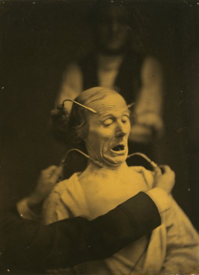 Expression de terreur - Guillaume Benjamin Amant Duchenne