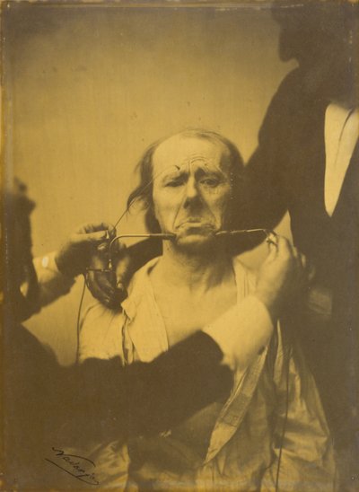Douleur et désespoir - Guillaume Benjamin Amant Duchenne
