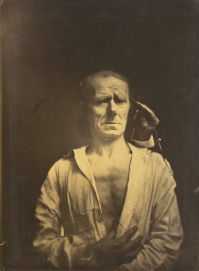 Spasme du m. corrugator supercilii sous une lumière très forte (gauche); Un visage détendu (photographié en plein soleil) (droite) - Guillaume Benjamin Amant Duchenne