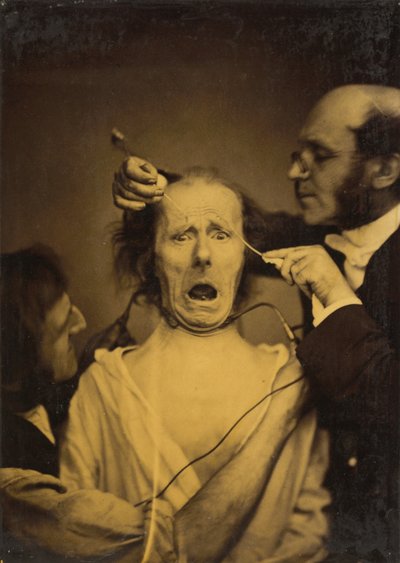 Terreur mêlée de douleur, torture - Guillaume Benjamin Amant Duchenne