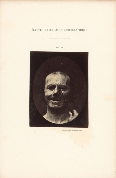 Électro-Physiologie Photographique, Figure 53 - Guillaume Benjamin Duchenne