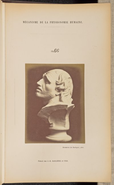Fig. 66 - Guillaume Benjamin Duchenne
