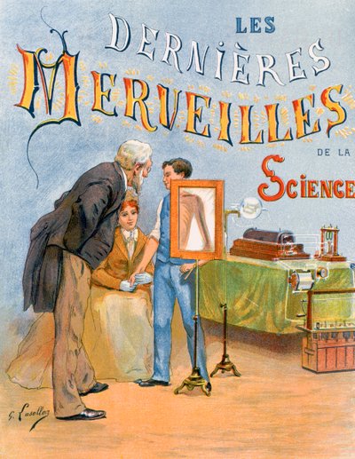 Examen du bras d