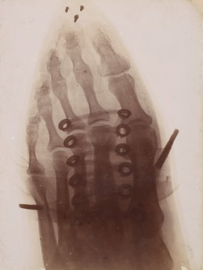 Le pied à travers la chaussure, 1896 - Henri van Heurck