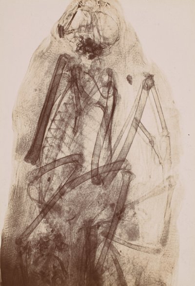 [Radiographie de la momie d