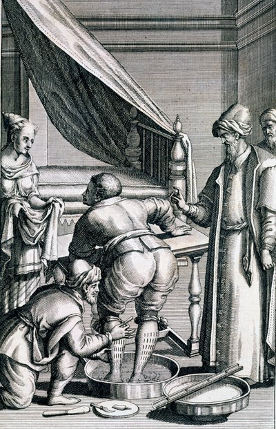 Saignée dans les jambes, de Medicina Aegyptiorum par Prospero Alpini, publié 1745 - Italian School