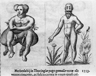 Différents types de monstres humains. Gravure de « De monstrorum natura, causis et differentiis » de Fortunio Liceti (1577-1656), scientifique italien. 1646 - Italian School