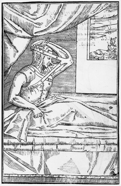Chirurgie reconstructive du nez, illustration de De curtorum chirurgia per insitionem par Gaspare Tagliacozzi (1545-99) Venise, publié en 1597 - Italian School