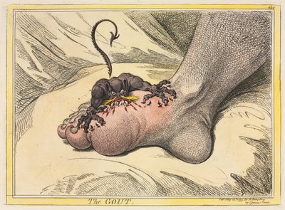 La Goutte, 1799 - James Gillray