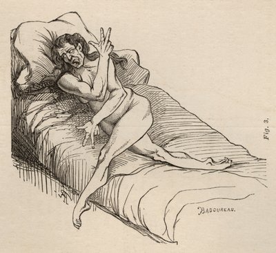 Épilepsie hystérique, attaque, contorsions, fig. 3 de 