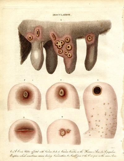 Inoculation et progression de la maladie - John Pass