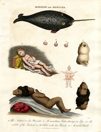 Narval et malformations - John Pass