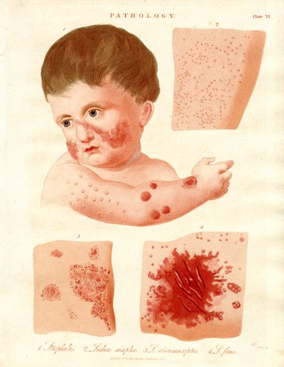 Maladies pathologiques de la peau - John Pass