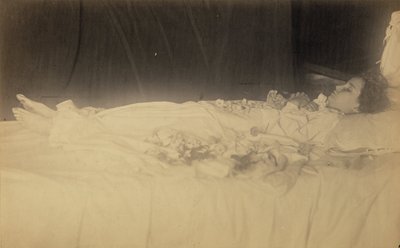 [Étude d