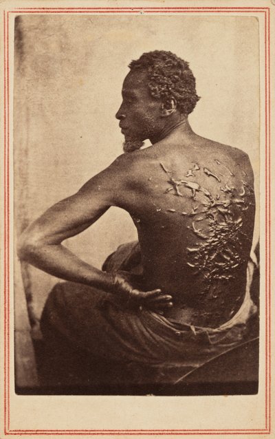 Le dos flagellé,v. 1863 (photo) - McPherson & Oliver