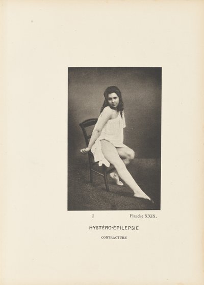 Hystéro-Épilepsie Contracture - Paul Marie Léon Regnard