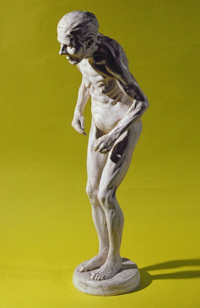 Figure d
