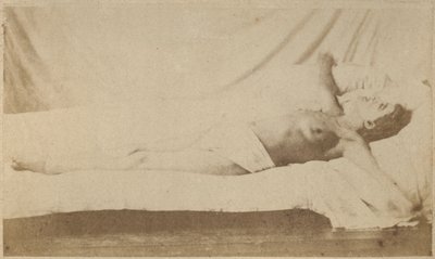 Épilepsie hystérique, attaque, crucifixion, planche VI de 