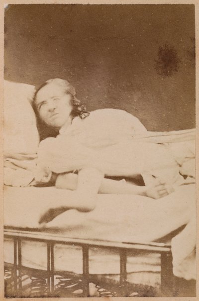 Épilepsie hystérique, contorsions, planche XXXVIII de 