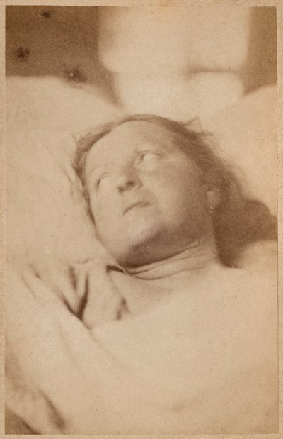 Épilepsie hystérique, crucifixion, attitude de la tête, planche VII de 