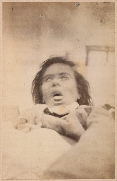 Épilepsie hystérique, hallucinations, angoisse, planche XXIX de 