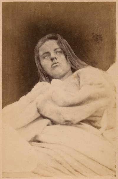 Épilepsie hystérique, hallucinations, dédain, planche XXXI de 